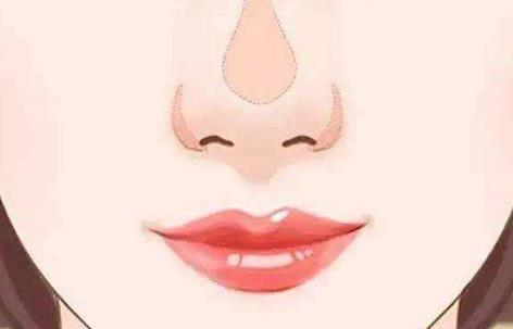 鼻頭縮小會不會有增生出現