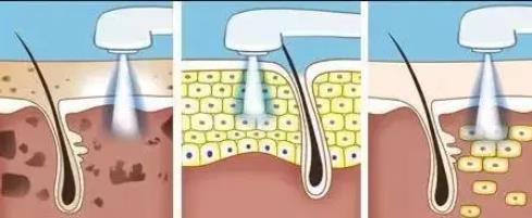 白瓷娃娃的作用是什么，有哪些美白飲食秘方