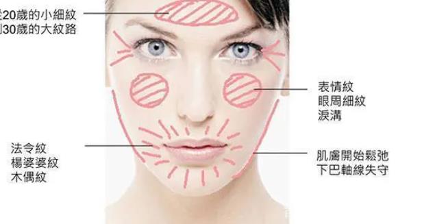 玻尿酸去除川字紋的注意事項(xiàng)有哪些?