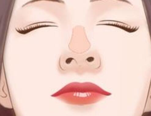 鼻孔縮小有沒有風(fēng)險？