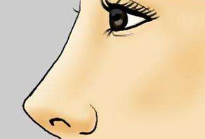 綜合整形鼻子的價格是多少?鼻子綜合整形多少錢?