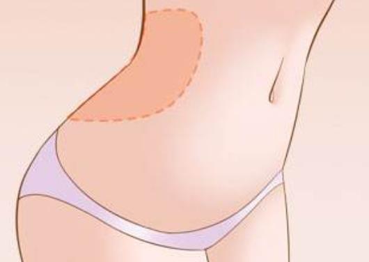 腹部吸脂哪些人適合和不適合?