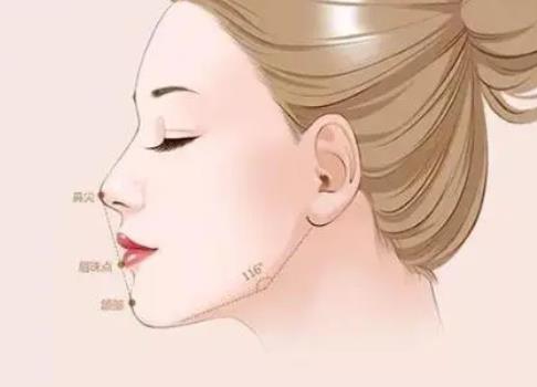 豐下巴是假體好還是玻尿酸好?