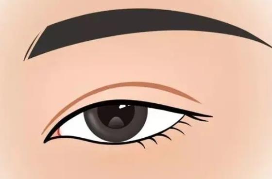 大小眼矯正的方法有哪些?