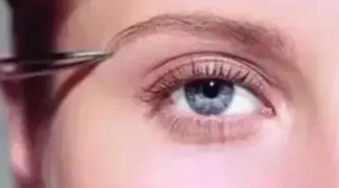 提眉術(shù)有什么優(yōu)點?提眉術(shù)和全切雙眼皮哪個更好?