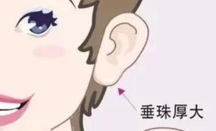 玻尿酸豐耳垂多久才能補(bǔ)打?玻尿酸豐耳垂的果如何呢