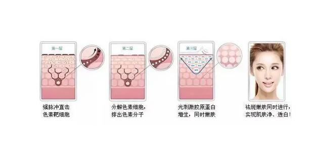 激光祛雀斑的風(fēng)險是什么?激光祛除雀斑大概需要多少錢