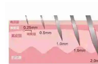 做完微針什么時(shí)候可以洗臉，做完微針有哪些注意事項(xiàng)?