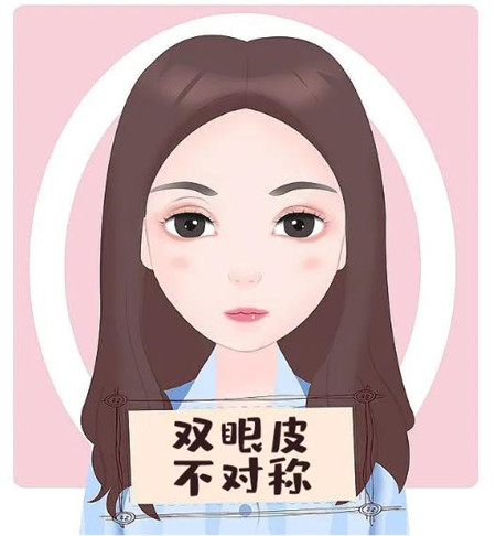 割雙眼皮失敗的原因一般有哪些