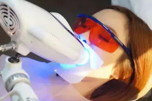 冷光美白儀的特點(diǎn)是什么？