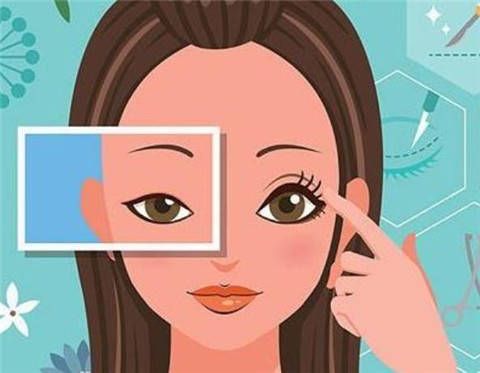 什么手術能更好的改良上瞼下垂，怎么改良？