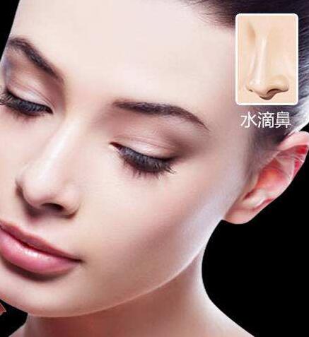 鼻翼縮小術多少錢?