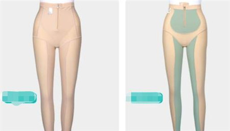 水動(dòng)力吸脂要多久才能上班，恢復(fù)期有哪些注意事項(xiàng)