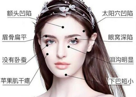 自體脂肪豐太陽穴手術(shù)前需要準備什么?