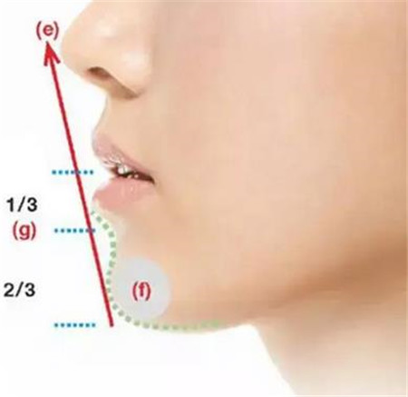 墊下巴的注意事項有哪些