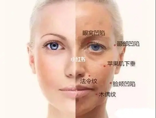 顳部填充有哪些方式和材料？顳部填充術后如何護理?