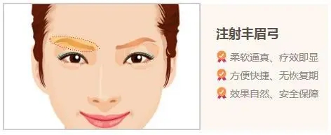 自體脂肪填充眉弓有危險(xiǎn)嗎?有什么后遺癥?