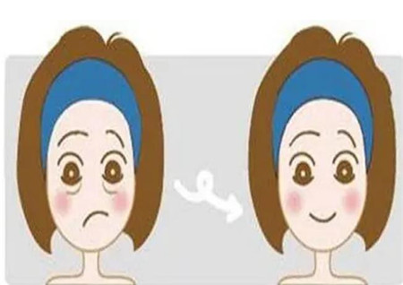 懸吊提升除皺手術(shù)的優(yōu)勢和特點