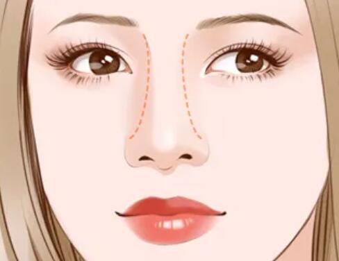 哪些情況適合鼻孔縮小？