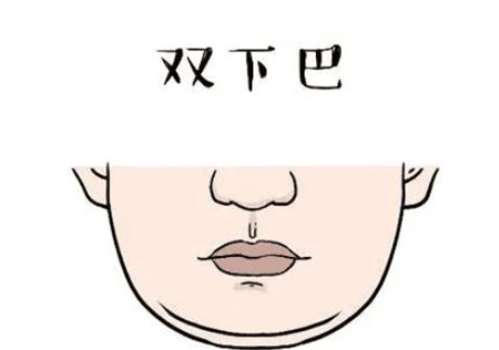 墊下巴的材料有哪些，有什么好處