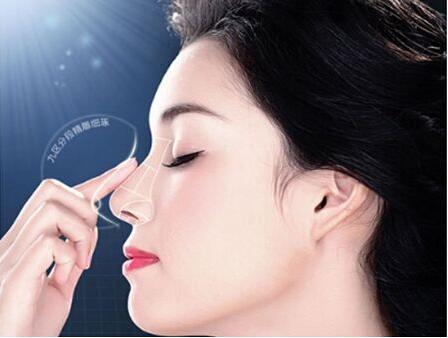 鼻小柱的理想形狀是什么?如何判斷自己是否鼻小柱缺損?