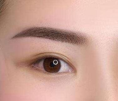 誰(shuí)做過(guò)眉弓隆高?眉弓隆高術(shù)是什么?