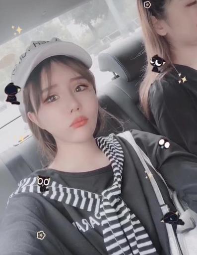 溫州醫(yī)科大學附屬第一醫(yī)院瘦臉案例專家點評！價格、口碑曝光