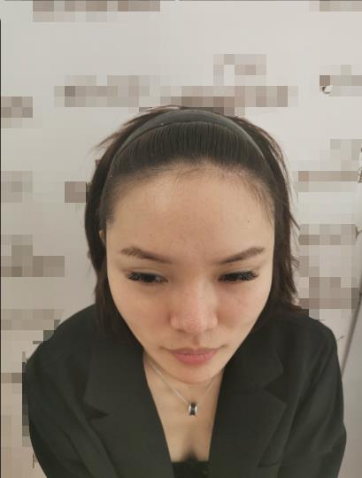 北京美萊植發(fā)醫(yī)生董海英個人資料_醫(yī)院價目表及口碑案例供參考