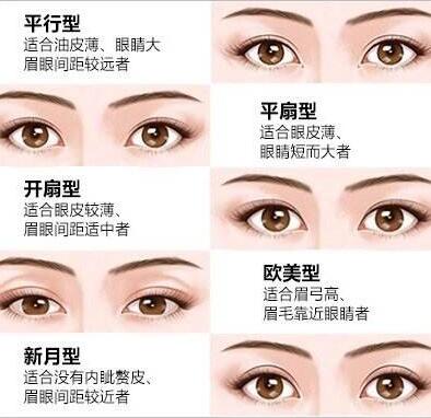 雙眼皮修復(fù)是怎么做的?雙眼皮修復(fù)注意事項(xiàng)盤點(diǎn)