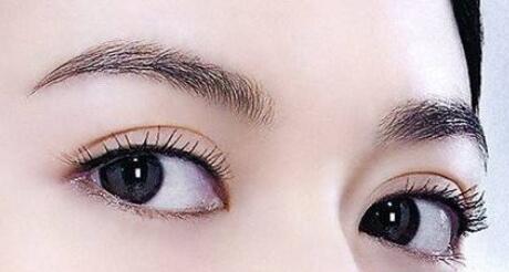 修復(fù)雙眼皮需要多久呢?雙眼皮修復(fù)手術(shù)疼嗎?