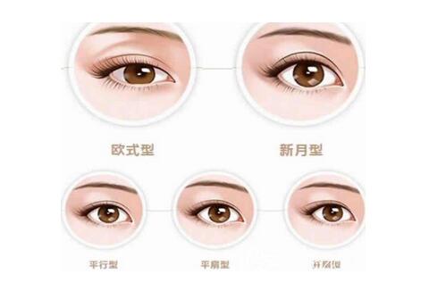 眼睛雙眼皮可以修幾次?雙眼皮修復(fù)注意事項(xiàng)?