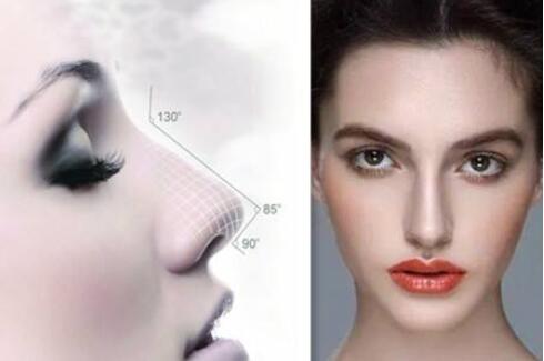 廣州有哪些鼻尖整形的方法?