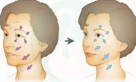 自體脂肪填充淚溝恢復(fù)注意事項？