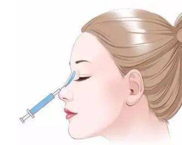 注射隆鼻能維持多久?如何保養(yǎng)?