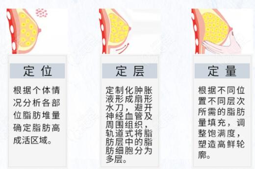 自體脂肪豐胸硬塊這種情況成因是什么?該怎么處理呢?