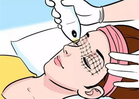 需要多久做一次熱瑪吉?適合什么年齡