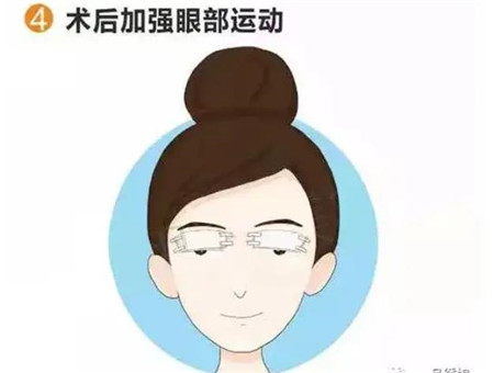 雙眼皮手術有哪些缺點以及怎么護理