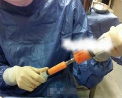 全身抽脂價格是多少?