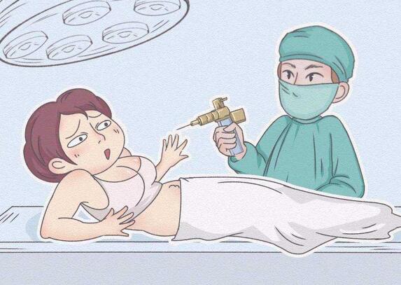 全身抽脂減肥多少錢價格貴嗎?