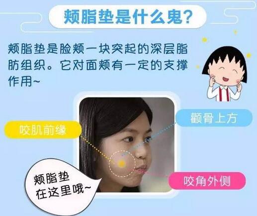 去頰脂墊價格貴嗎?大概價位是多少?