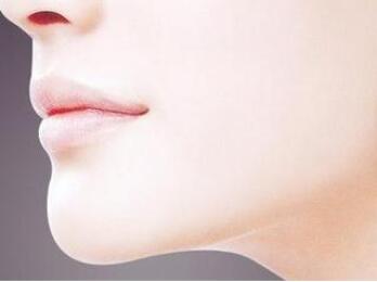 膨體隆下巴是*的嗎?有沒有后遺癥?