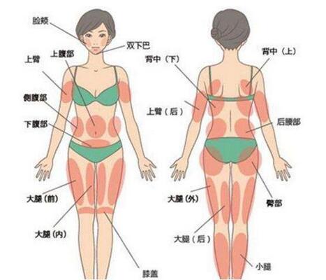 全身抽脂手術要多長時間，會全麻嗎?