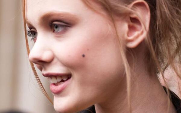 做微晶磨削去黑痣禁忌人群及適宜人群有哪些?