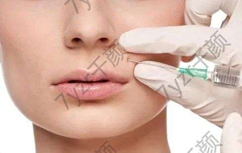 注射玻尿酸填充鼻唇溝有哪些優(yōu)點(diǎn)?
