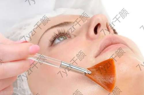 果酸換膚祛痘有什么優(yōu)勢?