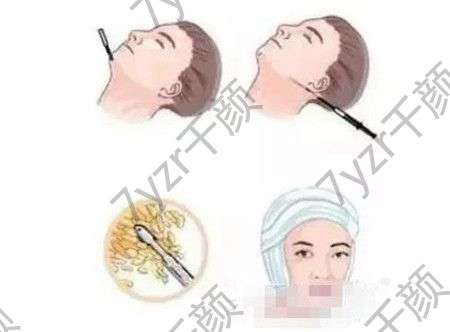 吸脂危險嗎，吸脂用全麻有什么優(yōu)勢