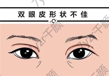 上瞼下垂可以調節(jié)嗎，有哪些調節(jié)方法