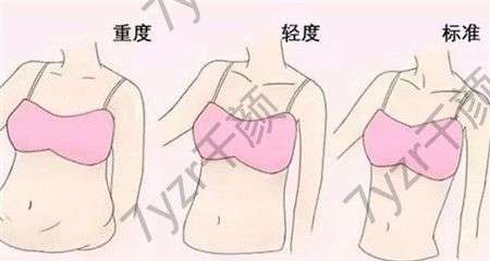 水動(dòng)力吸脂術(shù)有哪些優(yōu)點(diǎn)，會(huì)留疤嗎