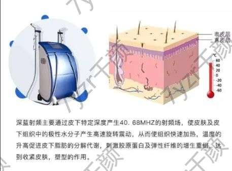 射頻緊膚有什么副作用，需要多少錢