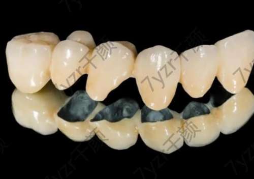 孕婦能做烤瓷牙嗎?